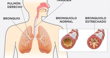 Sistema respiratorio - EPOC