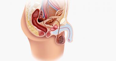 La balanitis causa dolor en el pene, inflamación y comezón
