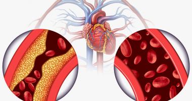 Inhibidores de ECA para la tensión arterial