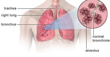 Persona sin bronconeumonía. Bronquiolos y alveolos sanos